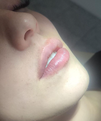 OROFACIAL AGENCY - Fangs Dentais Brasil
