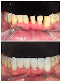 Clínica dental RV Odontología Integral. Dentista en Guadalajara