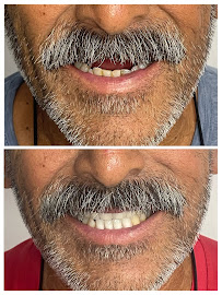 Clínica dental RV Odontología Integral. Dentista en Guadalajara