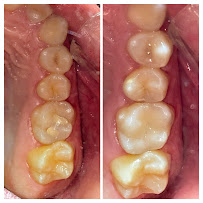 Clínica dental RV Odontología Integral. Dentista en Guadalajara