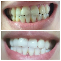 Clínica dental RV Odontología Integral. Dentista en Guadalajara