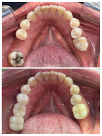Clínica dental RV Odontología Integral. Dentista en Guadalajara
