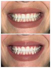 Clínica dental RV Odontología Integral. Dentista en Guadalajara