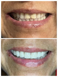 Clínica dental RV Odontología Integral. Dentista en Guadalajara
