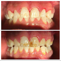 Clínica dental RV Odontología Integral. Dentista en Guadalajara