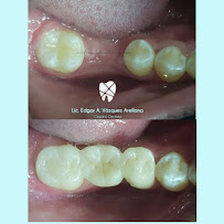 Clínica dental RV Odontología Integral. Dentista en Guadalajara