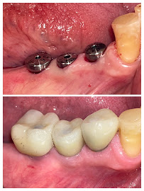 Clínica dental RV Odontología Integral. Dentista en Guadalajara