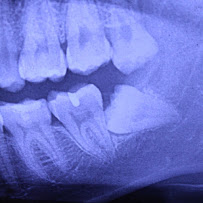Clínica dental RV Odontología Integral. Dentista en Guadalajara