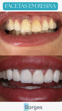 Grupo Borges Odontologia | Dentista Curitiba