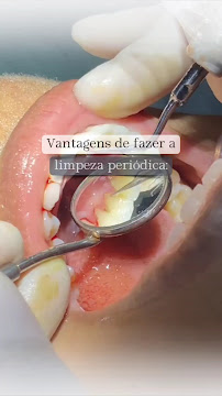 OdontoRec