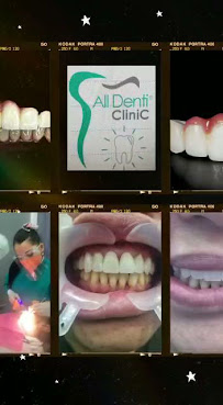 All Denti Clinic