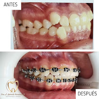 Dental HeRa Dra. Gabriela Hernández