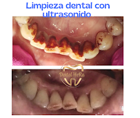 Dental HeRa Dra. Gabriela Hernández