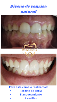 Dental HeRa Dra. Gabriela Hernández