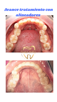 Dental HeRa Dra. Gabriela Hernández