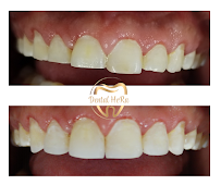 Dental HeRa Dra. Gabriela Hernández