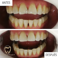 Dental HeRa Dra. Gabriela Hernández