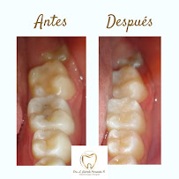 Dental HeRa Dra. Gabriela Hernández