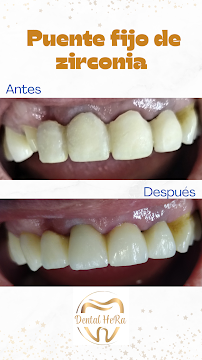 Dental HeRa Dra. Gabriela Hernández