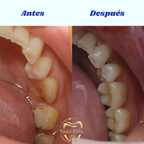 Dental HeRa Dra. Gabriela Hernández
