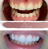 Amanda Soares Odontologia Especializada | Botox | Harmonização | Preenchimento