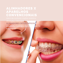 Amanda Soares Odontologia Especializada | Botox | Harmonização | Preenchimento