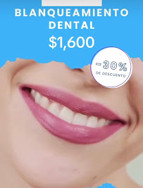 Dentista Guadalajara - Dr. Víctor Martínez