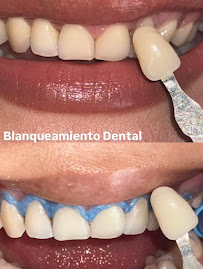 Dentista Guadalajara - Dr. Víctor Martínez