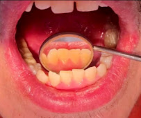 Dentista Guadalajara - Dr. Víctor Martínez