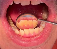 Dentista Guadalajara - Dr. Víctor Martínez