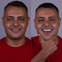 Odontologia Integrada Recife | Implantes sem corte, sem dor e resultado imediato | Dentista em Recife/PE