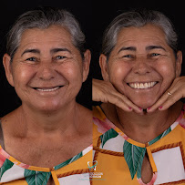 Odontologia Integrada Recife | Implantes sem corte, sem dor e resultado imediato | Dentista em Recife/PE