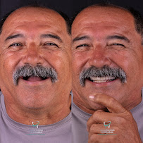 Odontologia Integrada Recife | Implantes sem corte, sem dor e resultado imediato | Dentista em Recife/PE