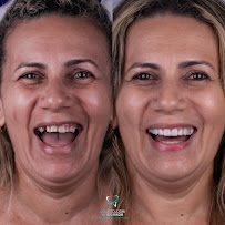 Odontologia Integrada Recife | Implantes sem corte, sem dor e resultado imediato | Dentista em Recife/PE
