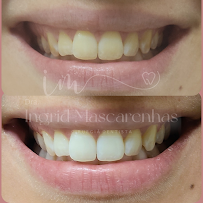 Dra Ingrid Mascarenhas - Dentista Recife