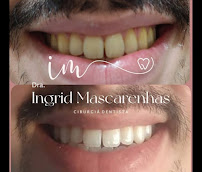 Dra Ingrid Mascarenhas - Dentista Recife