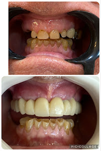 Dra Michelle Ribeiro | Dentista | Oral Recife Clínica Odontológica | Cirurgiã buco maxilo facial | Implante Dentário