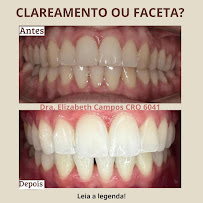 Dra. Elizabeth Campos Invisalign, aparelhos ortodônticos e clareamento