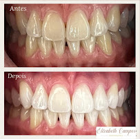 Dra. Elizabeth Campos Invisalign, aparelhos ortodônticos e clareamento