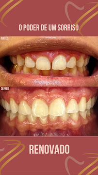 Dra. Elizabeth Campos Invisalign, aparelhos ortodônticos e clareamento