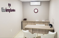 Eu Implantes - Recife/PE - Implantes Dentários