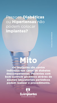 Eu Implantes - Recife/PE - Implantes Dentários