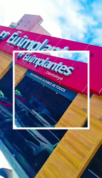 Eu Implantes - Recife/PE - Implantes Dentários