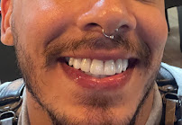 LN Odontologia - Dentista em Recife | Implantes Dentários l Invisalign | Facetas | Lente de Contato Dental