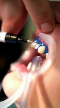 LN Odontologia - Dentista em Recife | Implantes Dentários l Invisalign | Facetas | Lente de Contato Dental