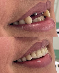 Dentista 24h | Elo Dent | Clínica Odontológica | Dentista em Goiânia GO | Implante Dentário
