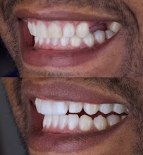 Dentista 24h | Elo Dent | Clínica Odontológica | Dentista em Goiânia GO | Implante Dentário