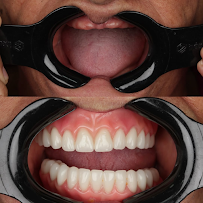 Dentista 24h | Elo Dent | Clínica Odontológica | Dentista em Goiânia GO | Implante Dentário