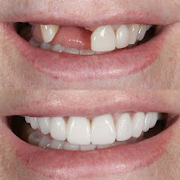 Dentista 24h | Elo Dent | Clínica Odontológica | Dentista em Goiânia GO | Implante Dentário