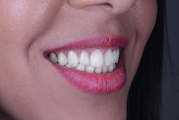 Clínica Infinity Dental e Facial